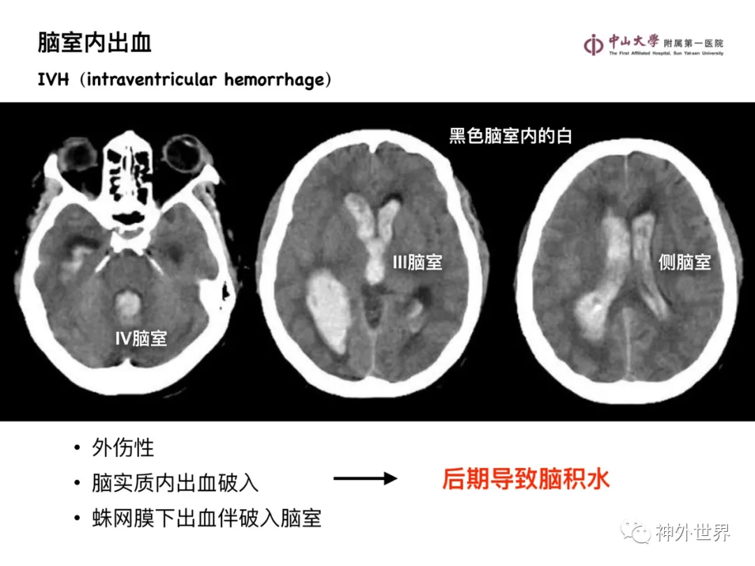 防盗门 第44页